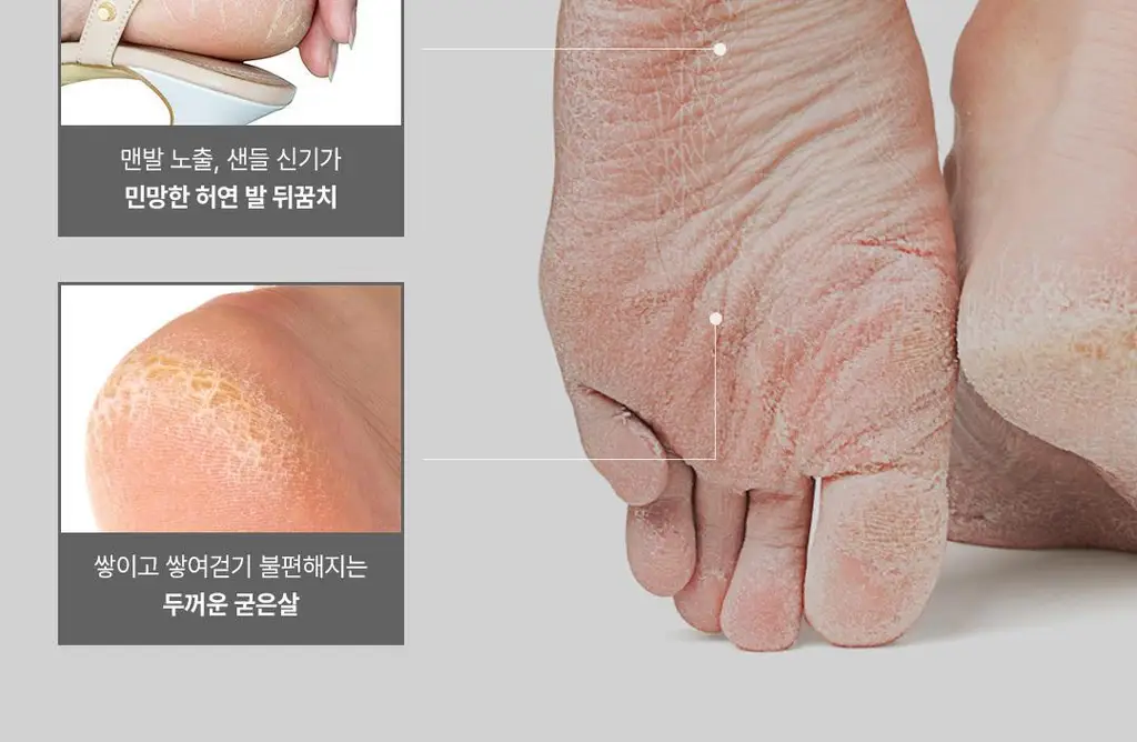 [발허물팩] 아리얼 스무스 앤 퓨어 풋 필링 마스크 2입 7종 택1 상세페이지 11